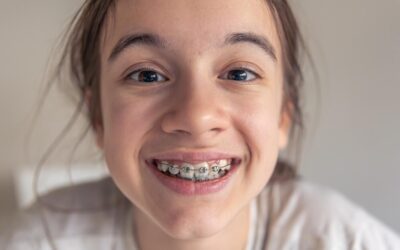 Braces for Teens in Katy, TX: Helping Your Teen Achieve a Confident Smile