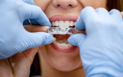 Invisalign in Katy, TX | Clear Braces for Straight Teeth | Affordable Invisalign Treatment