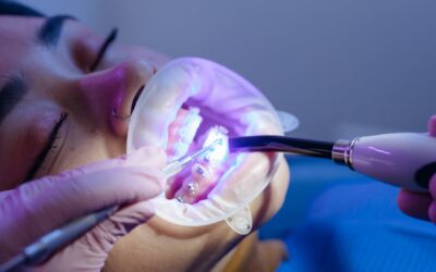 Why Braces Treatment in Katy Is the Key to a Healthier, More Confident Smile