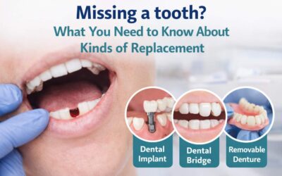 Missing a tooth? What You Need to Know About Kinds of Replacement