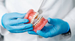 How to Choose the Best Orthodontist in Katy TX for Long Term Smile Results