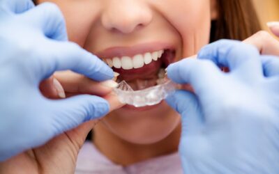 Why More Adults Are Choosing Braces Treatment in Katy, TX to Improve Their Smiles